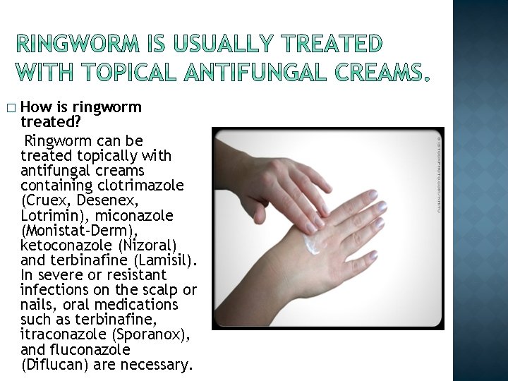 � How is ringworm treated? Ringworm can be treated topically with antifungal creams containing � How is ringworm treated? Ringworm can be treated topically with antifungal creams containing