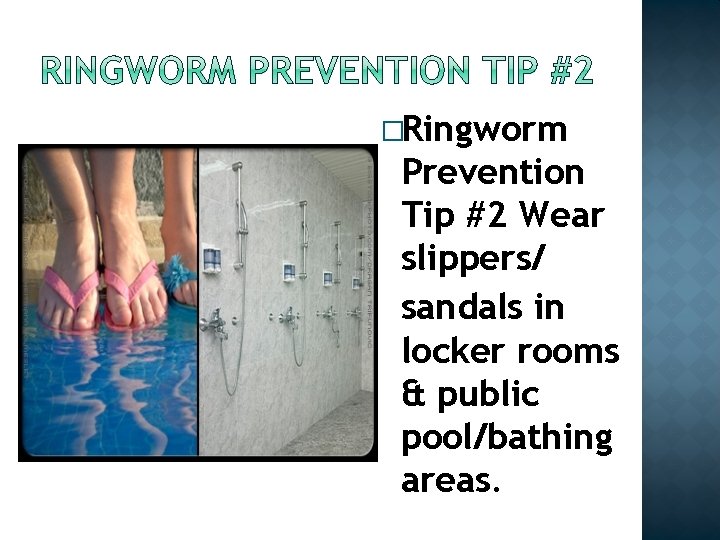�Ringworm Prevention Tip #2 Wear slippers/ sandals in locker rooms & public pool/bathing areas. �Ringworm Prevention Tip #2 Wear slippers/ sandals in locker rooms & public pool/bathing areas.