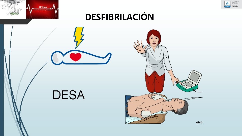 DESFIBRILACIÓN DESA 