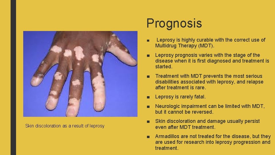 Prognosis Skin discoloration as a result of leprosy ■ Leprosy is highly curable with