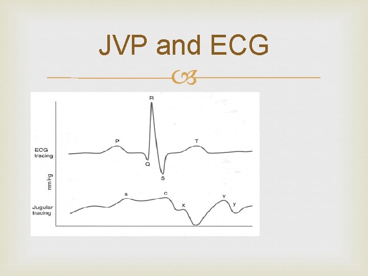 JVP and ECG 