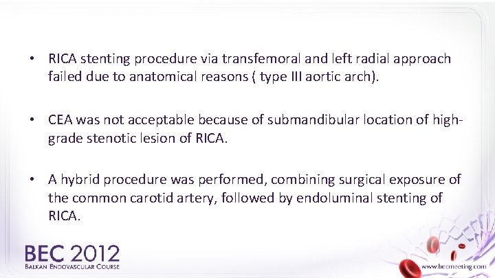  • RICA stenting procedure via transfemoral and left radial approach failed due to