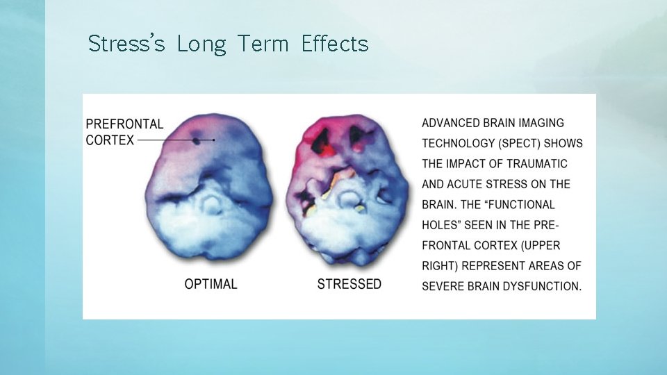 Stress’s Long Term Effects 