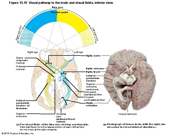 Figure 15. 19 Visual pathway to the brain and visual fields, inferior view. Both