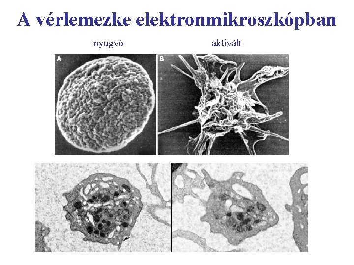 A vérlemezke elektronmikroszkópban nyugvó aktivált 