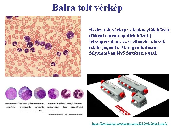 Balra tolt vérkép • Balra tolt vérkép: a leukocyták között (főként a neutrophilek között)