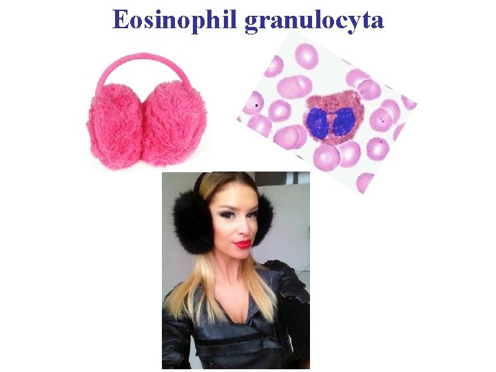 Eosinophil granulocyta 