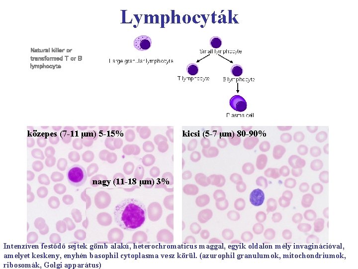 Lymphocyták Natural killer or transformed T or B lymphocyte közepes (7 -11 μm) 5