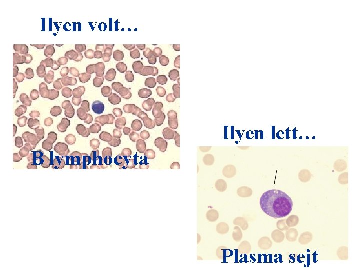 Ilyen volt… Ilyen lett… B lymphocyta Plasma sejt 