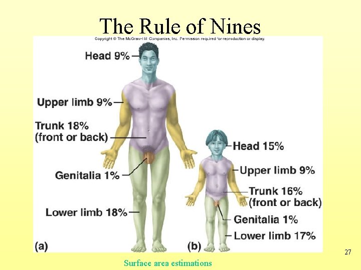 The Rule of Nines 27 Surface area estimations 