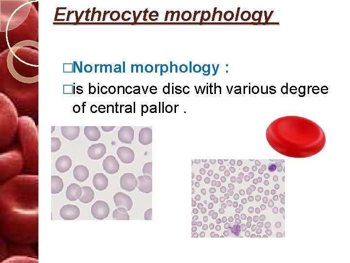 Erythrocyte morphology �Normal morphology : �is biconcave disc with various degree of central pallor.