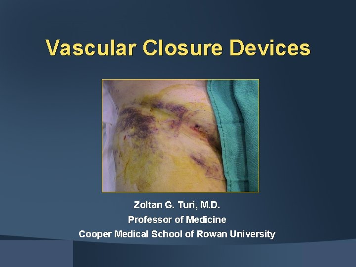 Vascular Closure Devices Zoltan G. Turi, M. D. Professor of Medicine Cooper Medical School