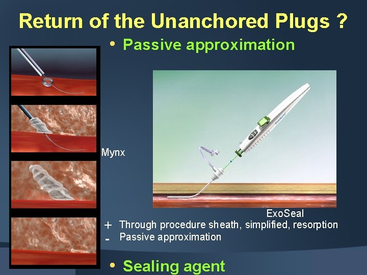 Return of the Unanchored Plugs ? • Passive approximation Mynx - Exo. Seal Through