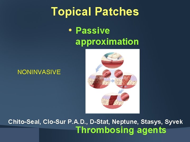 Topical Patches • Passive approximation NONINVASIVE Chito-Seal, Clo-Sur P. A. D. , D-Stat, Neptune,