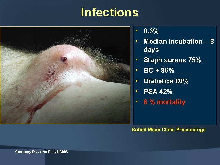 Infections • 0. 3% • Median incubation – 8 days • • • Staph
