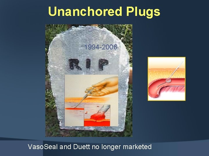 Unanchored Plugs 1994 -2006 Vaso. Seal and Duett no longer marketed 