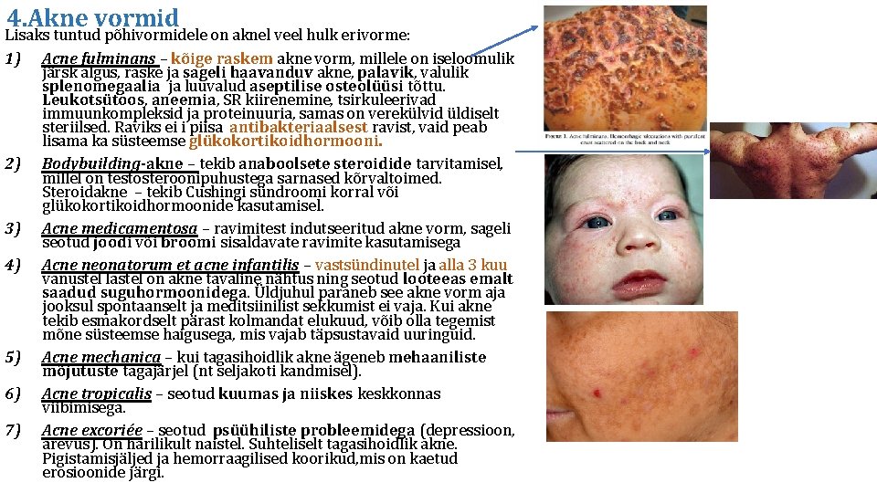 4. Akne vormid Lisaks tuntud põhivormidele on aknel veel hulk erivorme: 1) Acne fulminans