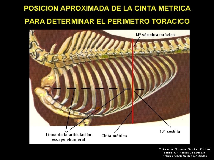 POSICION APROXIMADA DE LA CINTA METRICA PARA DETERMINAR EL PERIMETRO TORACICO Tratado del Síndrome