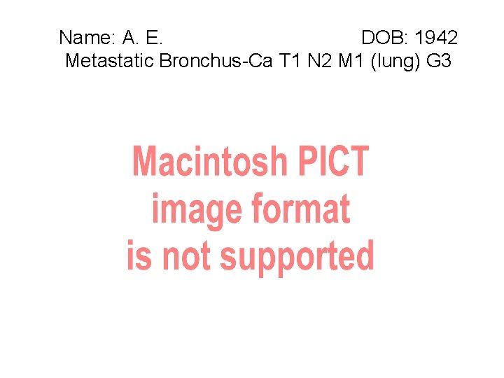 Name: A. E. DOB: 1942 Metastatic Bronchus-Ca T 1 N 2 M 1 (lung)