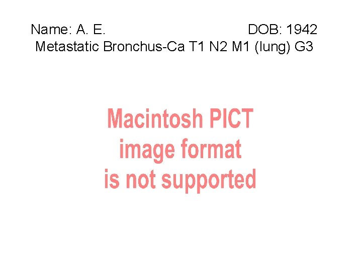 Name: A. E. DOB: 1942 Metastatic Bronchus-Ca T 1 N 2 M 1 (lung)