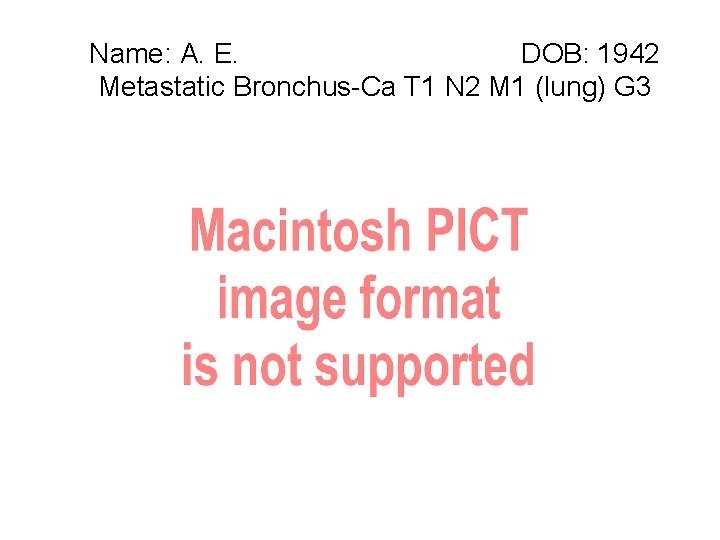 Name: A. E. DOB: 1942 Metastatic Bronchus-Ca T 1 N 2 M 1 (lung)