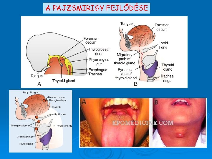 A PAJZSMIRIGY FEJLŐDÉSE 