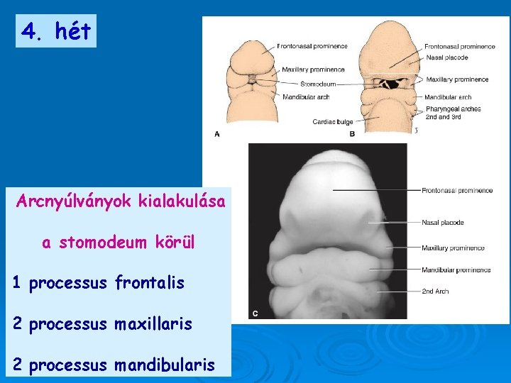 4. hét Arcnyúlványok kialakulása a stomodeum körül 1 processus frontalis 2 processus maxillaris 2