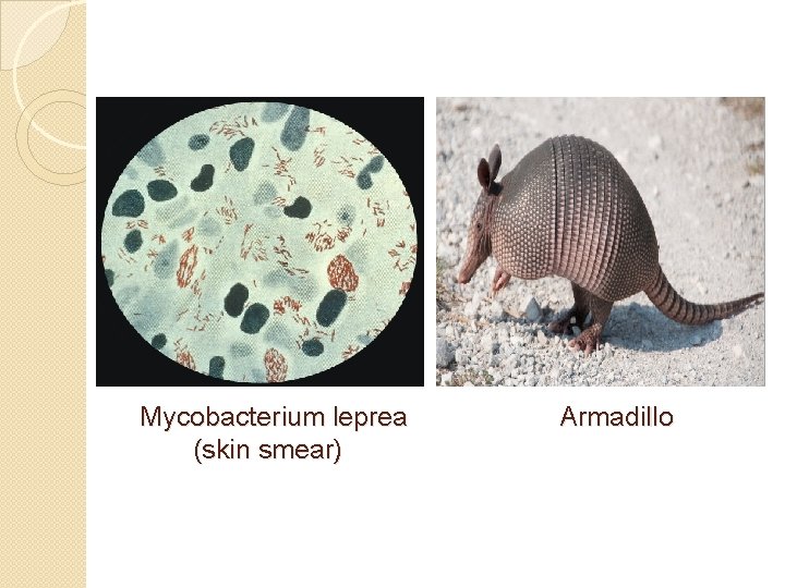 Mycobacterium leprea (skin smear) Armadillo 