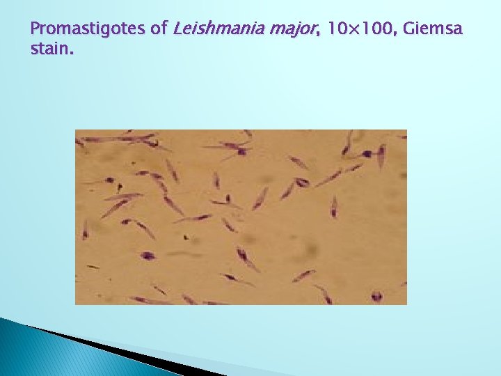 Promastigotes of Leishmania major, 10× 100, Giemsa stain. 