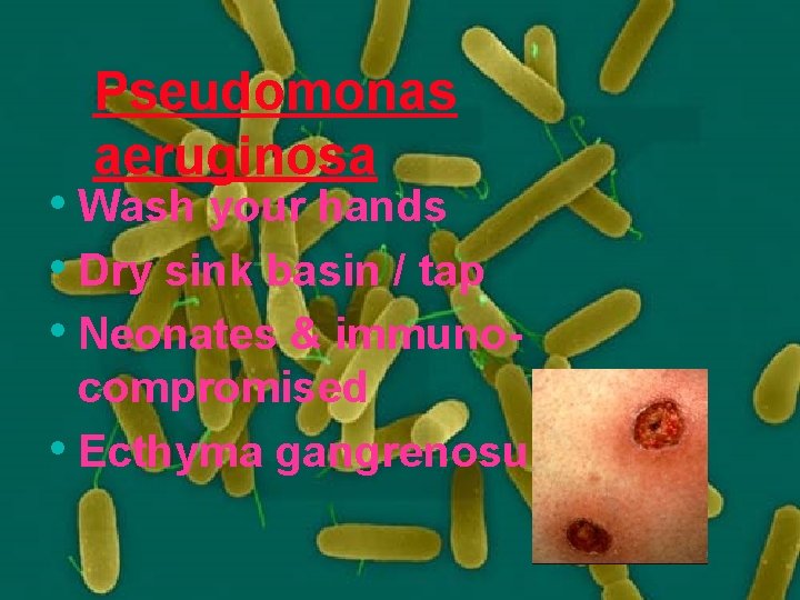 Pseudomonas aeruginosa • Wash your hands • Dry sink basin / tap • Neonates