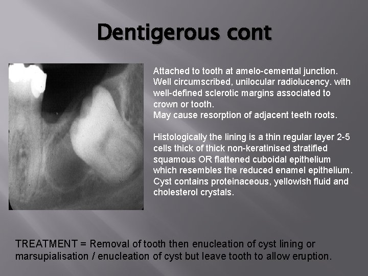 Dentigerous cont Attached to tooth at amelo-cemental junction. Well circumscribed, unilocular radiolucency. with well-defined