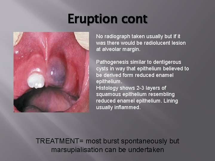 Eruption cont No radiograph taken usually but if it was there would be radiolucent