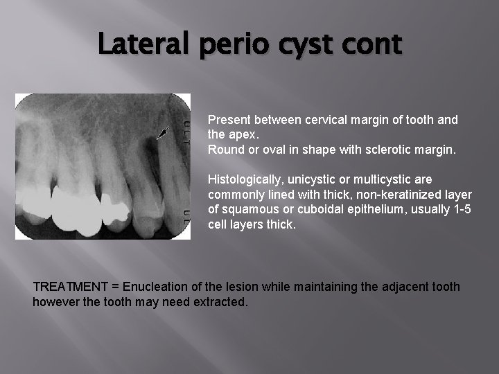 Lateral perio cyst cont Present between cervical margin of tooth and the apex. Round