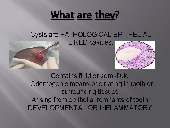 What are they? Cysts are PATHOLOGICAL EPITHELIAL LINED cavities. Contains fluid or semi-fluid. Odontogenic What are they? Cysts are PATHOLOGICAL EPITHELIAL LINED cavities. Contains fluid or semi-fluid. Odontogenic