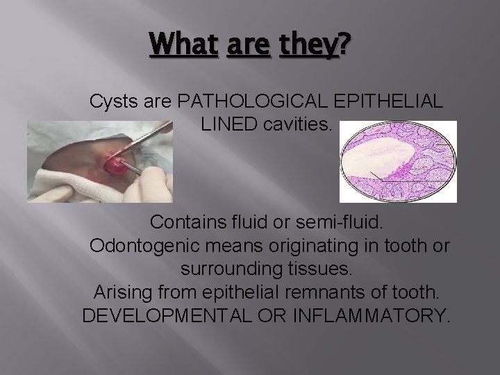 What are they? Cysts are PATHOLOGICAL EPITHELIAL LINED cavities. Contains fluid or semi-fluid. Odontogenic