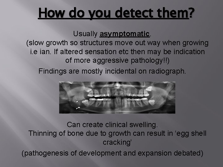 How do you detect them? Usually asymptomatic. (slow growth so structures move out way How do you detect them? Usually asymptomatic. (slow growth so structures move out way