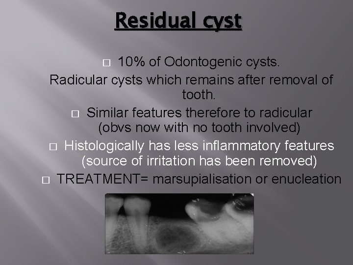 Residual cyst 10% of Odontogenic cysts. Radicular cysts which remains after removal of tooth. Residual cyst 10% of Odontogenic cysts. Radicular cysts which remains after removal of tooth.