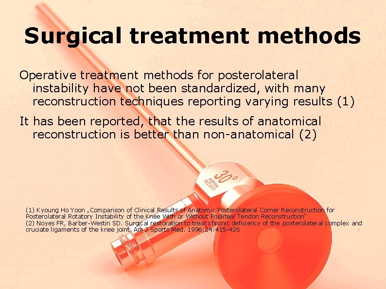 Surgical treatment methods Operative treatment methods for posterolateral instability have not been standardized, with