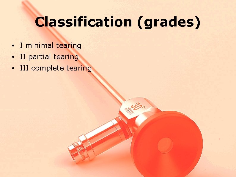 Classification (grades) • I minimal tearing • II partial tearing • III complete tearing