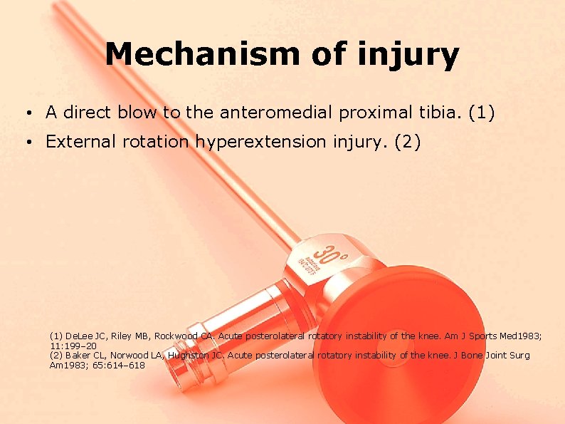 Mechanism of injury • A direct blow to the anteromedial proximal tibia. (1) •