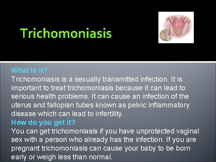 Trichomoniasis What is it? Trichomoniasis is a sexually transmitted infection. It is important to