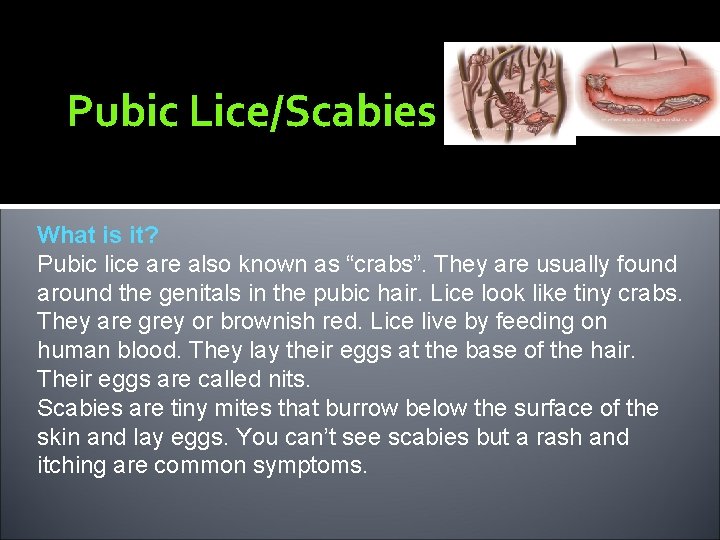 Pubic Lice/Scabies What is it? Pubic lice are also known as “crabs”. They are