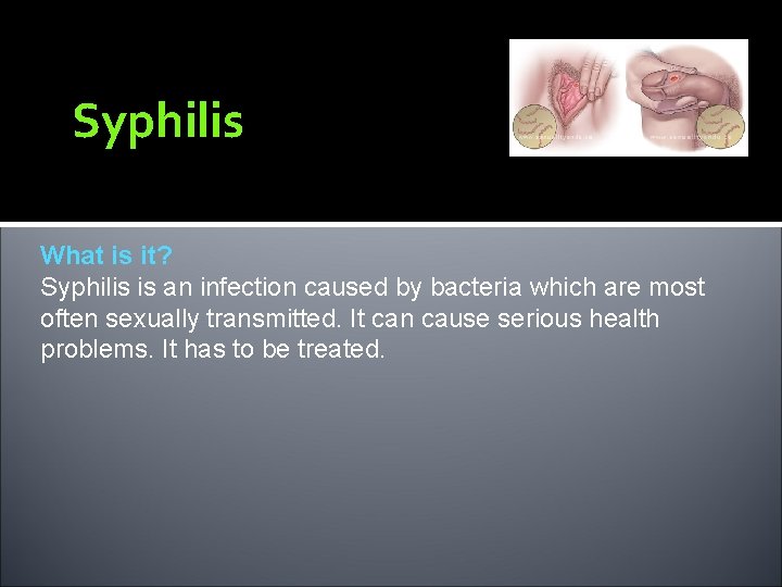 Syphilis What is it? Syphilis is an infection caused by bacteria which are most