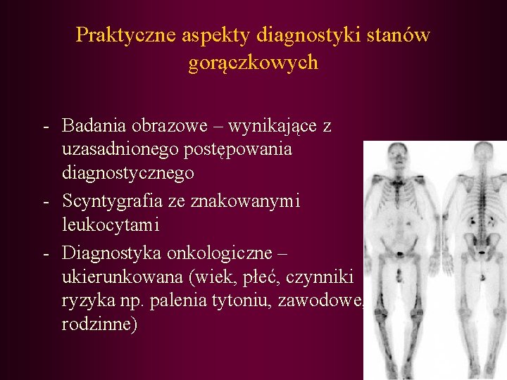 Praktyczne aspekty diagnostyki stanów gorączkowych - Badania obrazowe – wynikające z uzasadnionego postępowania diagnostycznego