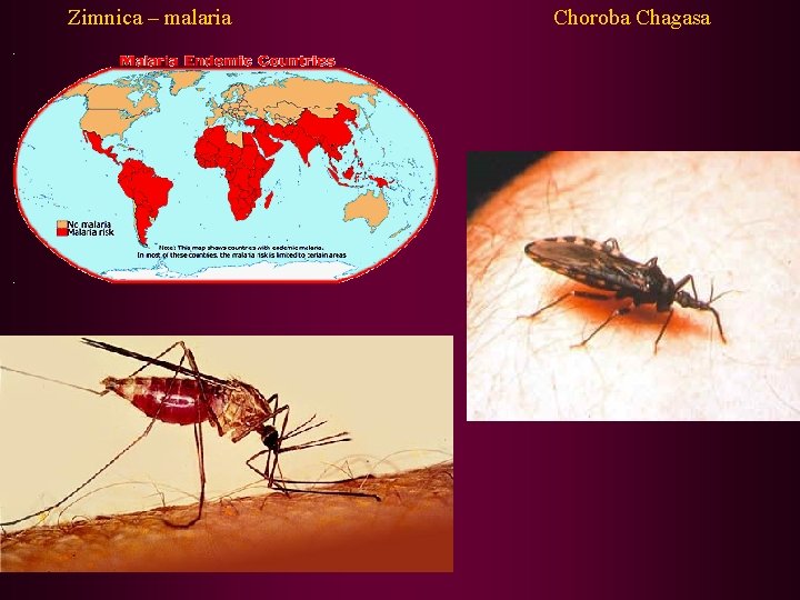 Zimnica – malaria Choroba Chagasa 