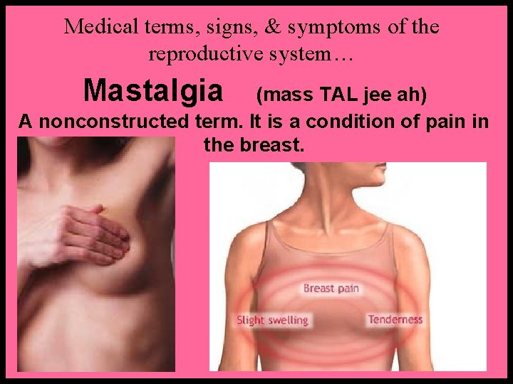 Medical terms, signs, & symptoms of the reproductive system… Mastalgia (mass TAL jee ah)