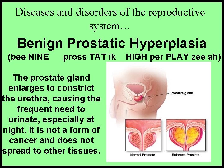 Diseases and disorders of the reproductive system… Benign Prostatic Hyperplasia (bee NINE pross TAT