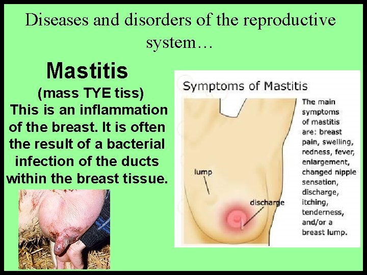 Diseases and disorders of the reproductive system… Mastitis (mass TYE tiss) This is an