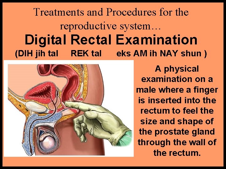 Treatments and Procedures for the reproductive system… Digital Rectal Examination (DIH jih tal REK