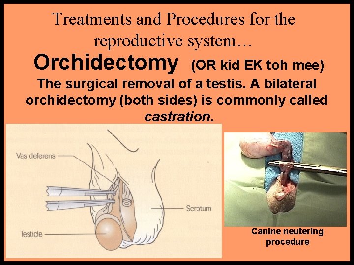 Treatments and Procedures for the reproductive system… Orchidectomy (OR kid EK toh mee) The